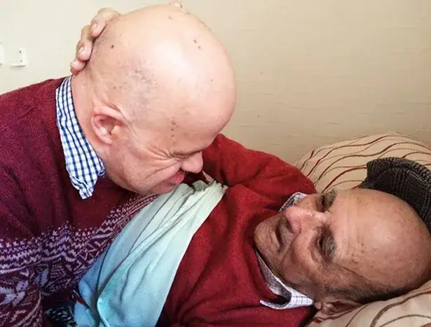 61-year old man with Down syndrome dies after hospital leaves him without food for 20 days