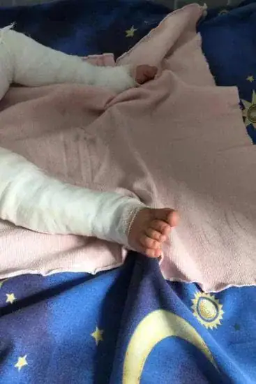 11-month-old boy who was ‘clinging onto life’ after falling into boiling water has died