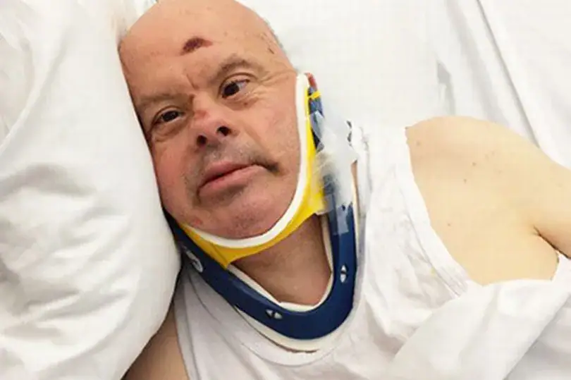 61-year old man with Down syndrome dies after hospital leaves him without food for 20 days