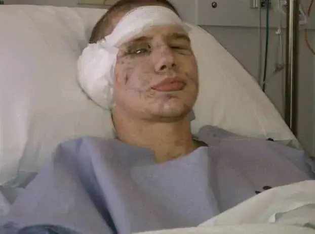 21-year-old awarded Medal of Honor after jumping on a grenade to save fellow Marine
