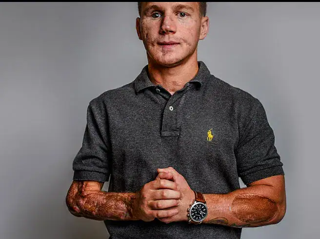 21-year-old awarded Medal of Honor after jumping on a grenade to save fellow Marine