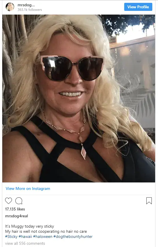 Dog the Bounty Hunter’s wife Beth releases statement on cancer battle