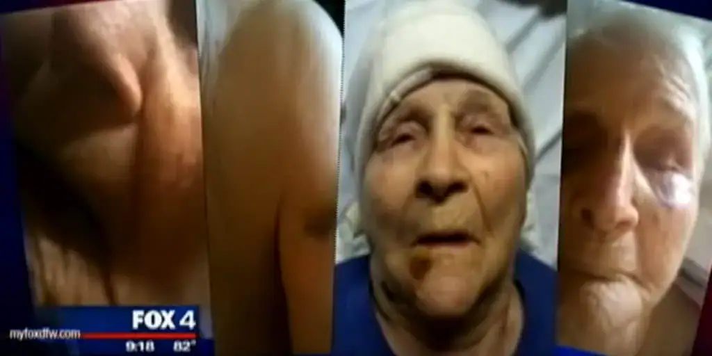 Age 98 grandma keeps ‘falling out of wheelchair’, so family installs camera to see if nurses are lying