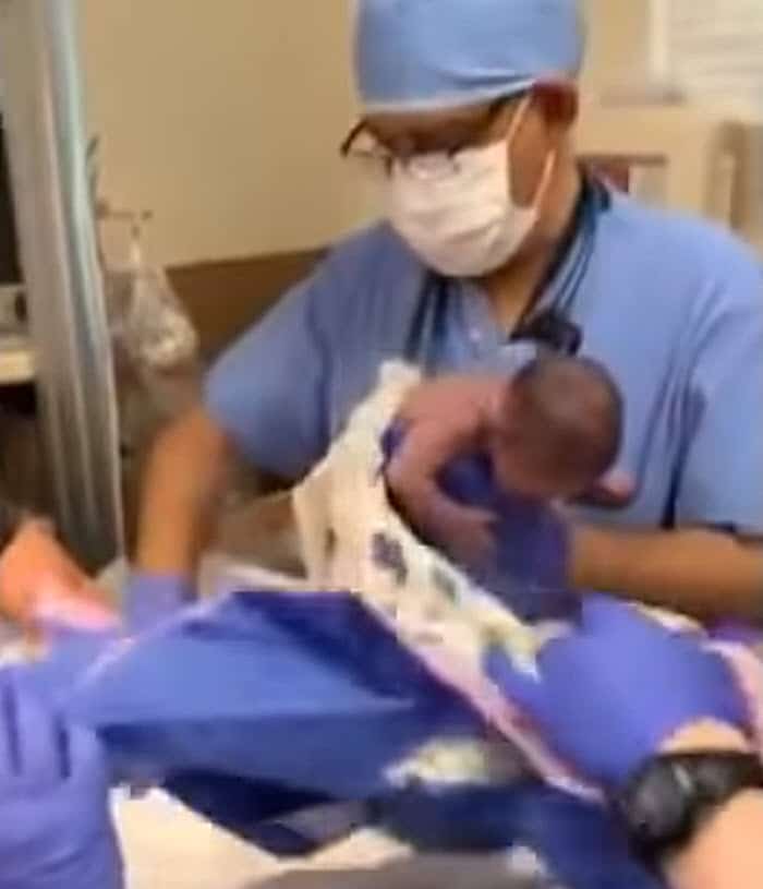 Family records birth when premature baby is suddenly dropped on her head in delivery room