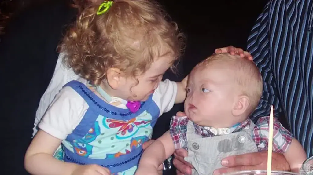 Tragedy as ‘Miracle baby’ born without a nose passes away at age two