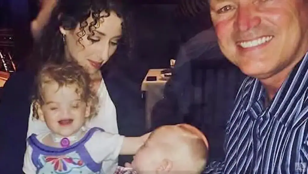 Tragedy as ‘Miracle baby’ born without a nose passes away at age two