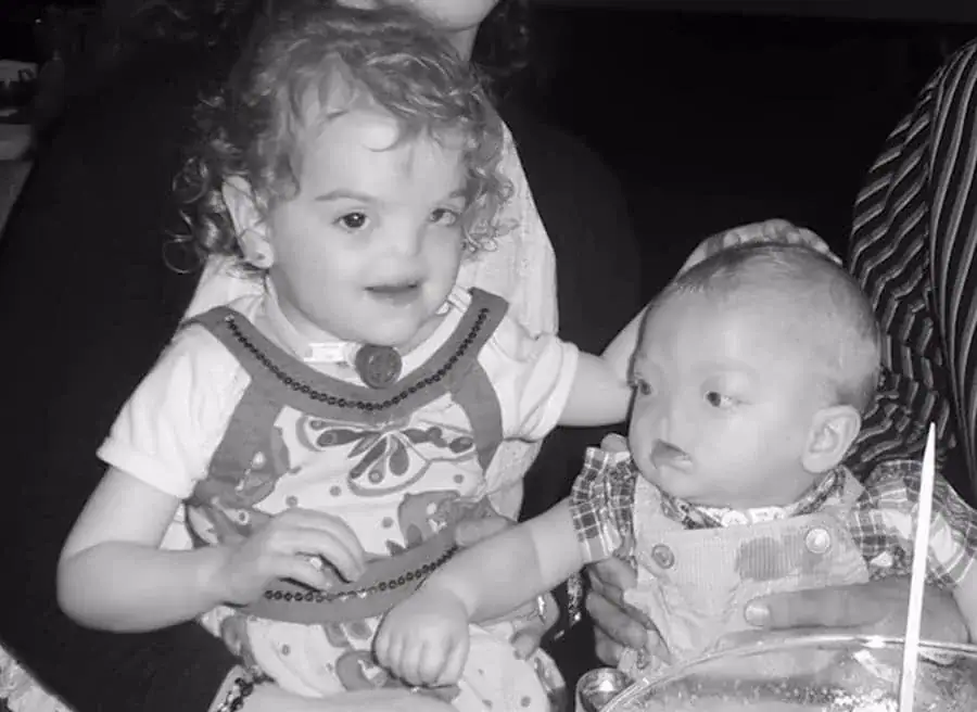 Tragedy as ‘Miracle baby’ born without a nose passes away at age two