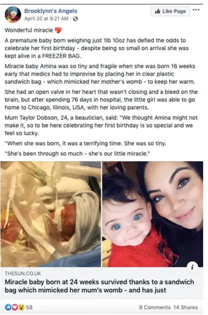 Baby born 16 weeks premature weighing only a pound just celebrated her first birthday