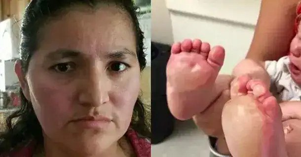 Mom finds large blisters on her baby’s feet, days later police unravel disturbing truth