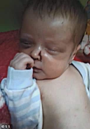 Baby fighting for his life after mom beats him and goes out on date – he needs our prayers
