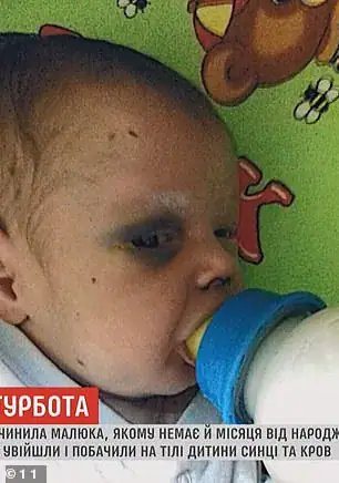 Baby fighting for his life after mom beats him and goes out on date – he needs our prayers