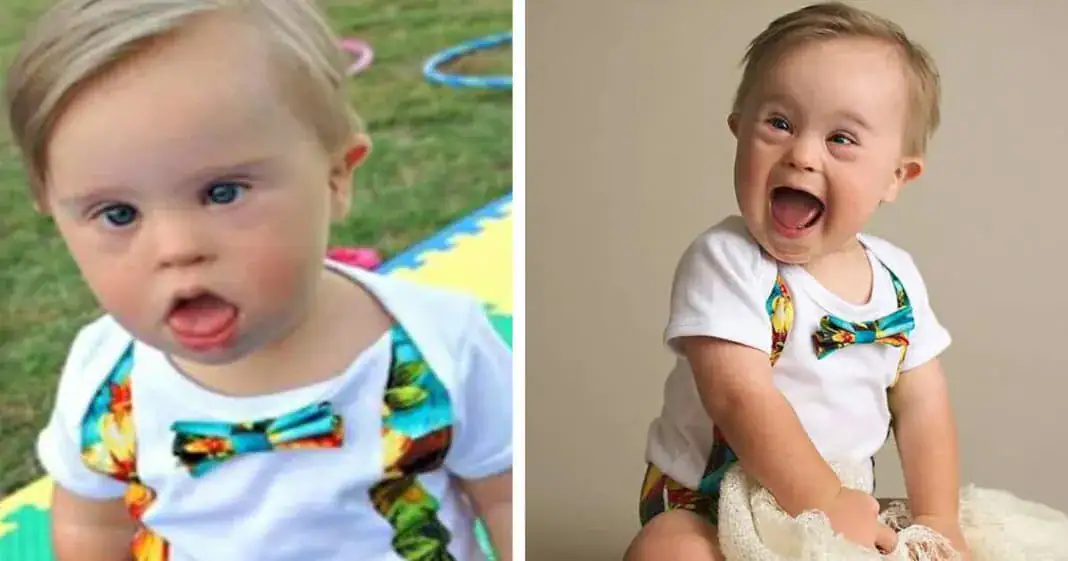 Baby rejected by modeling agency for having Down syndrome becomes popular, lands major ad campaign