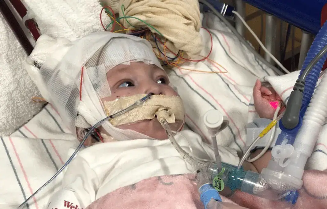 Autumn Fox, 6-month-old, heart transplant, Tallahassee