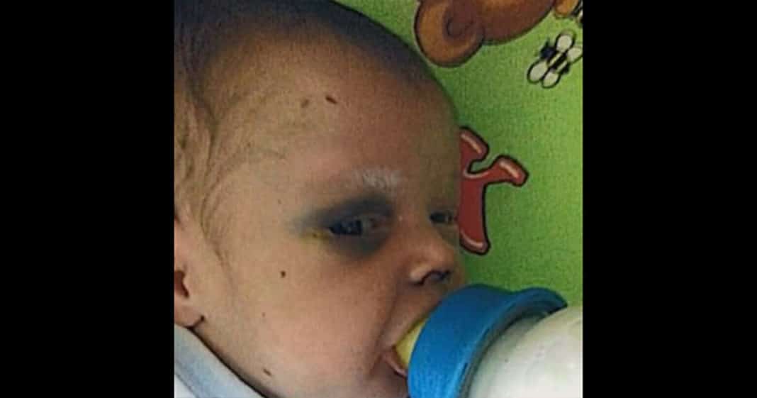 Baby fighting for his life after mom beats him and goes out on date – he needs our prayers