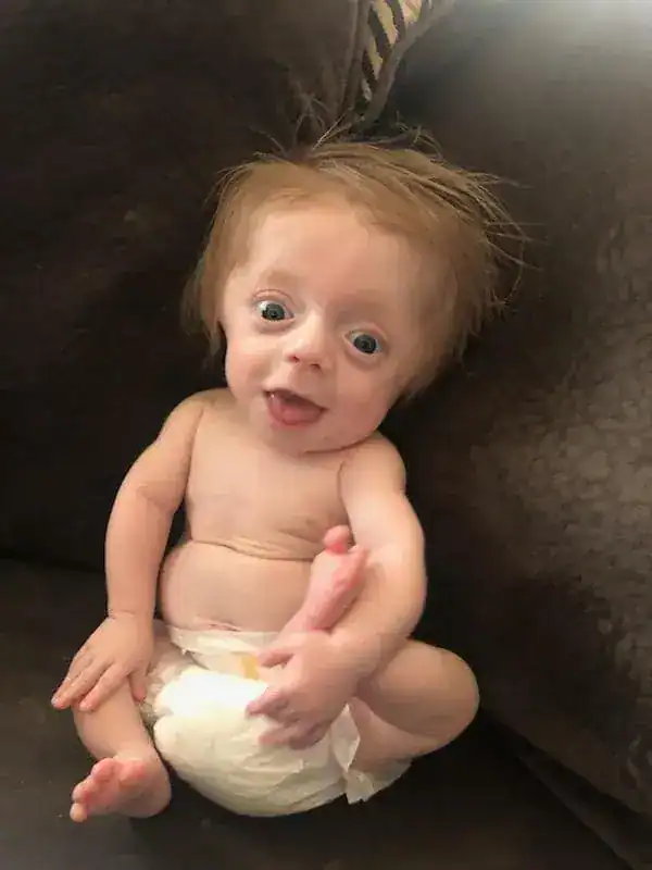 Newborn with fatal diagnosis defies all odds to become family’s ‘fighter’ – let’s show him some love