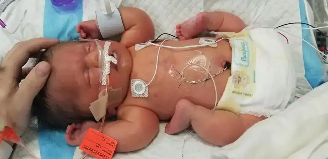 Newborn with fatal diagnosis defies all odds to become family’s ‘fighter’ – let’s show him some love