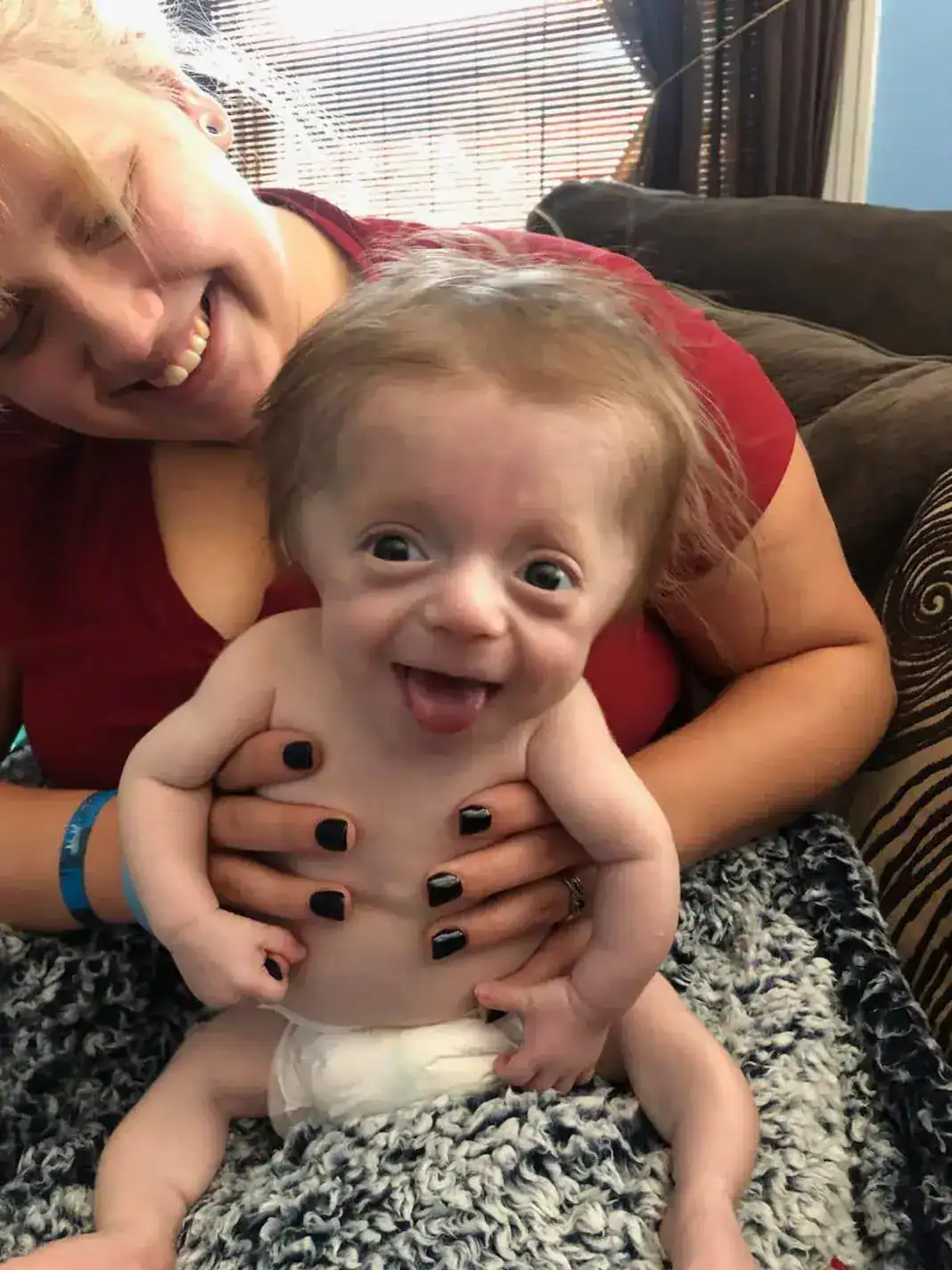 Newborn with fatal diagnosis defies all odds to become family’s ‘fighter’ – let’s show him some love