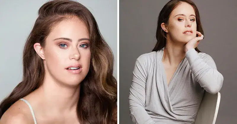Champion gymnast with Down syndrome becomes a model and paves the way for others like her