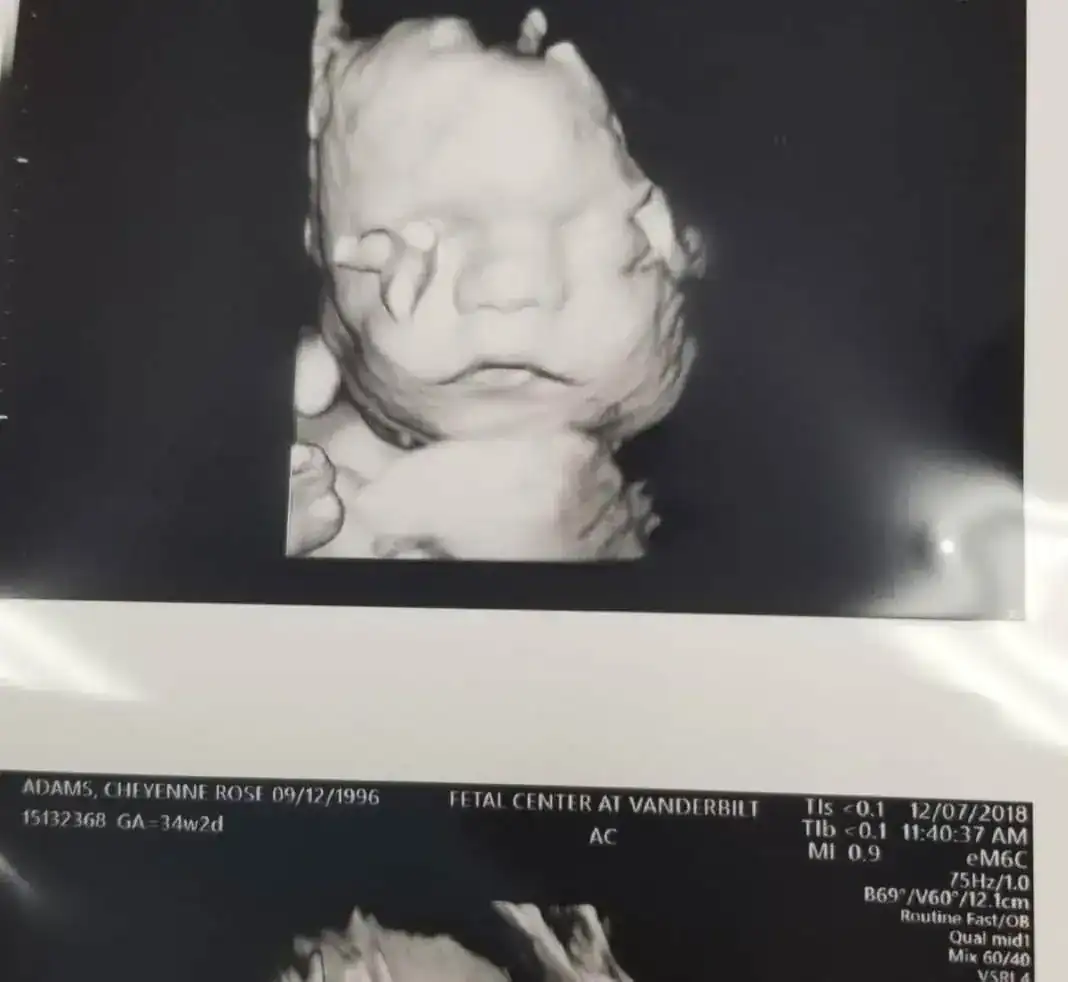 Newborn with fatal diagnosis defies all odds to become family’s ‘fighter’ – let’s show him some love