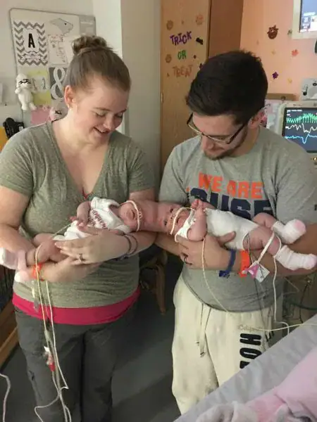 One year after their separation, conjoined twins are celebrating their new lives – wish them well