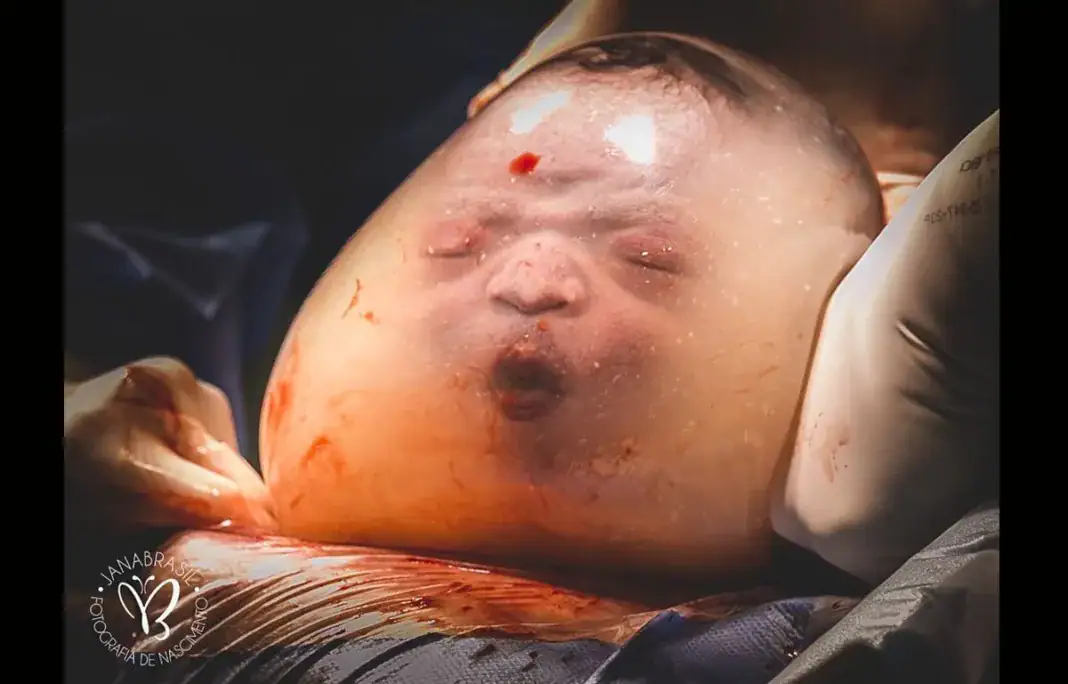 en caul birth, Noah Valasco, Jana Brasil