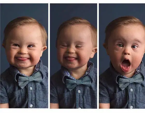 Baby rejected by modeling agency for having Down syndrome becomes popular, lands major ad campaign