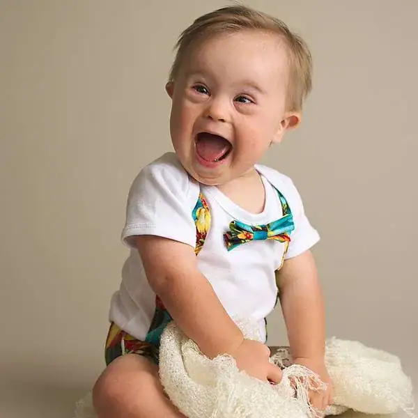 Baby rejected by modeling agency for having Down syndrome becomes popular, lands major ad campaign
