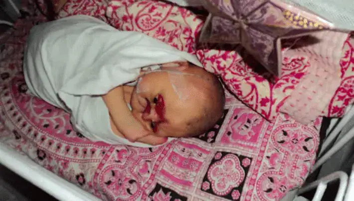 Mom takes one look at newborn son’s face and threatens to kill him, so nurse takes him home instead