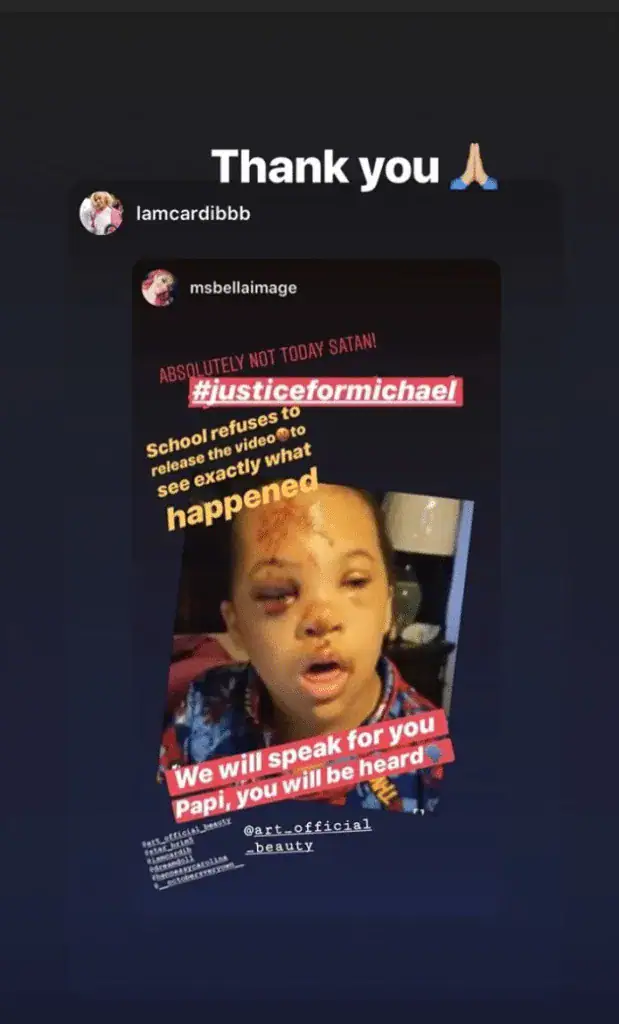 Family livid after school refuses to share video showing how age 7 son with Down syndrome was injured on bus