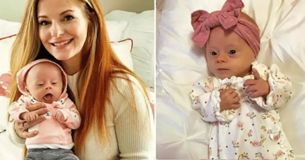 Mom opens up with the truth about what it’s like having a child with Down syndrome