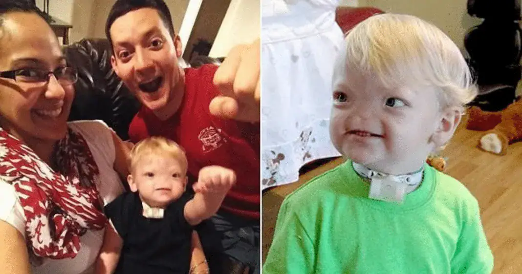 Tragedy as ‘Miracle baby’ born without a nose passes away at age two