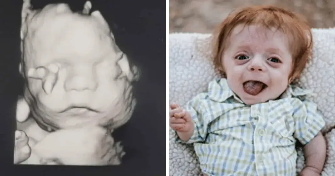 Newborn with fatal diagnosis defies all odds to become family’s ‘fighter’ – let’s show him some love