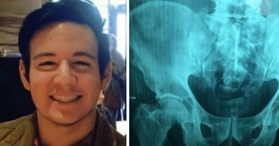 17-year-old complains of stomach ache to school nurse, only to die just two hours later