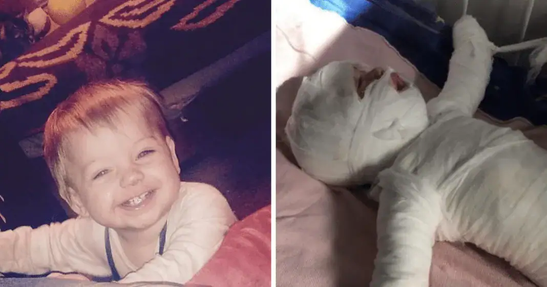 11-month-old boy who was ‘clinging onto life’ after falling into boiling water has died