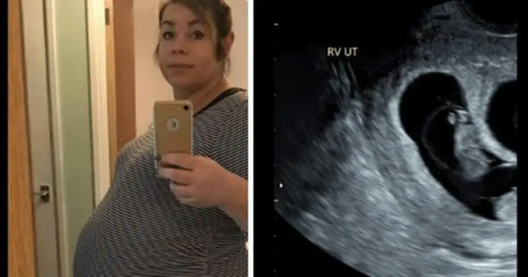 Wife struggles to conceive for 7 long years – when doctor shows her ultrasound she almost faints