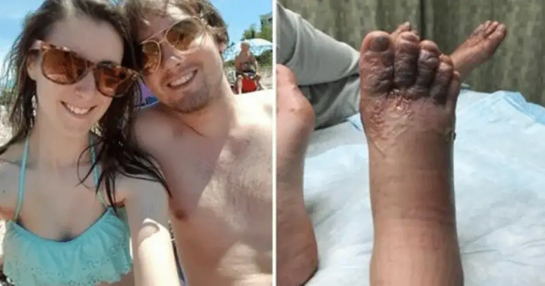 Couple spot something strange on feet after romantic beach stroll, authorities refused to help