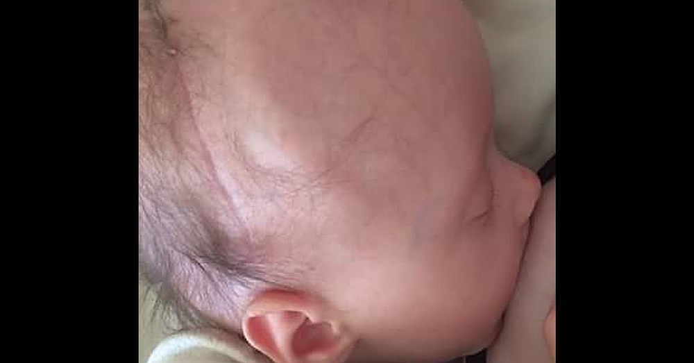 Mom’s Photo Breastfeeding Her Baby Through Chemo Goes Viral