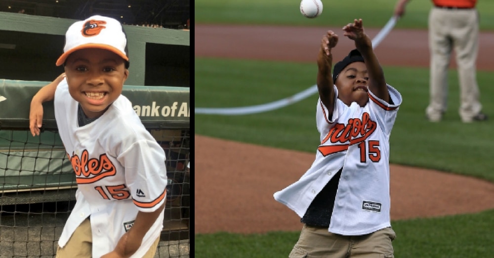 Watch: 1st Child Ever To Receive Double Hand Transplant Throws First Pitch At Orioles Game