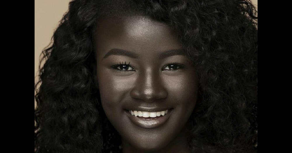 Teen Bullied For Incredibly Dark Skin Color Becomes Model, Takes Internet By Storm!