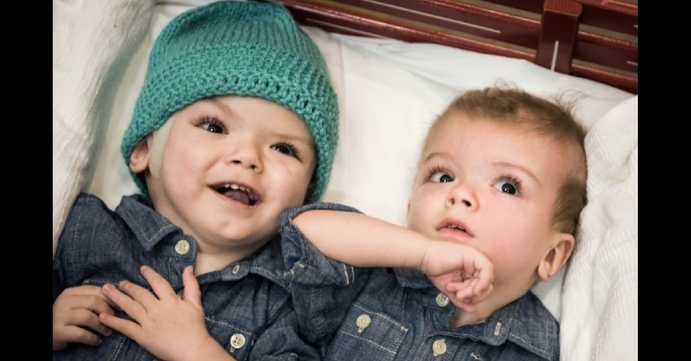 Separated Twins Finally Move Out Of Hospital After Emotional Goodbye