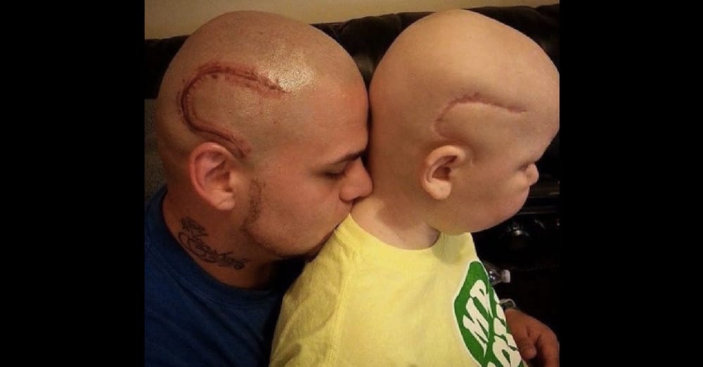 Dad Goes Viral When He Gets Scar Tattoo For Son. Now It’s His Son’s Turn To Keep Him Strong