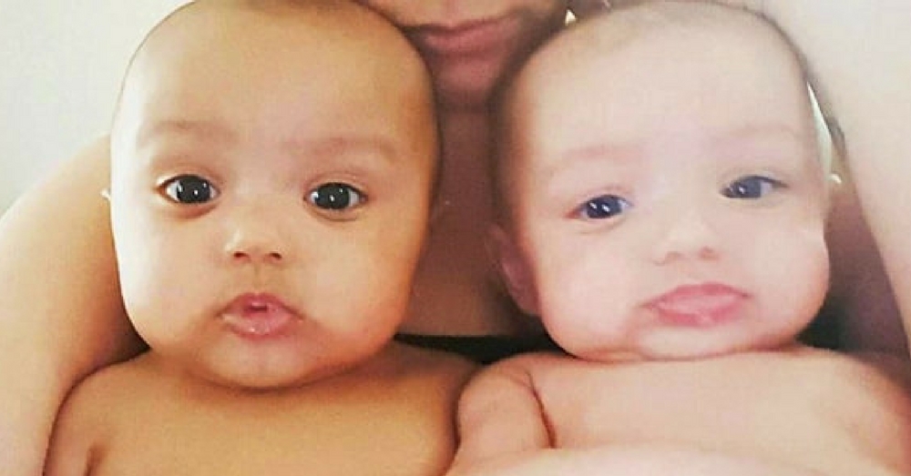 Mom Notices Something ‘Off’ About Twins. What Doctor Says Next Leaves Her In Disbelief