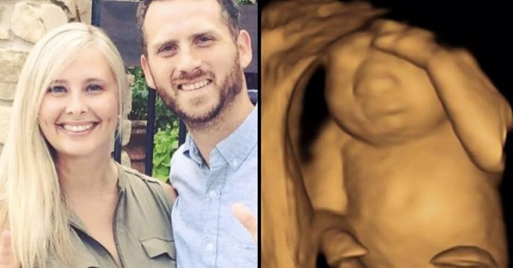 Doctors Tell Mom Baby Will Die At Birth. What She Says Next Leaves Entire Room Speechless