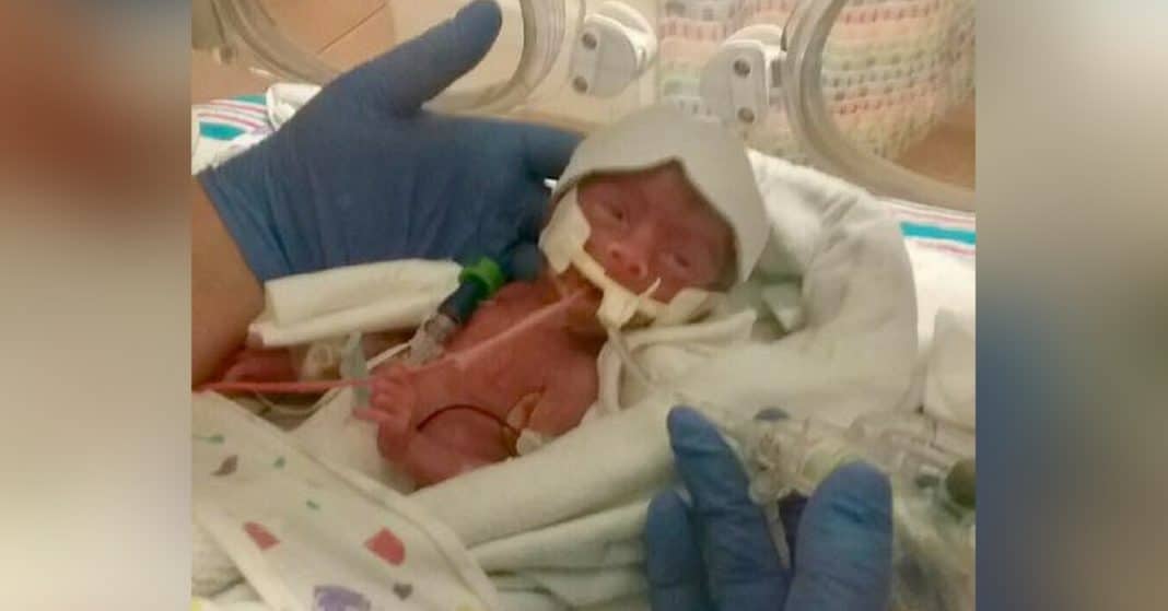 Doctors Tell Heartbroken Parents To Say Goodbye To Baby. That’s When They Start To Pray