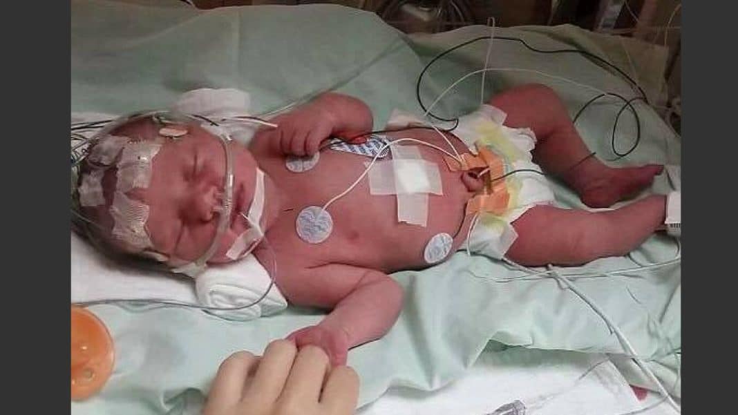 Baby Suffers Stroke In The Womb, 1 Year After Birth She’s Defying Doctors’ Expectations