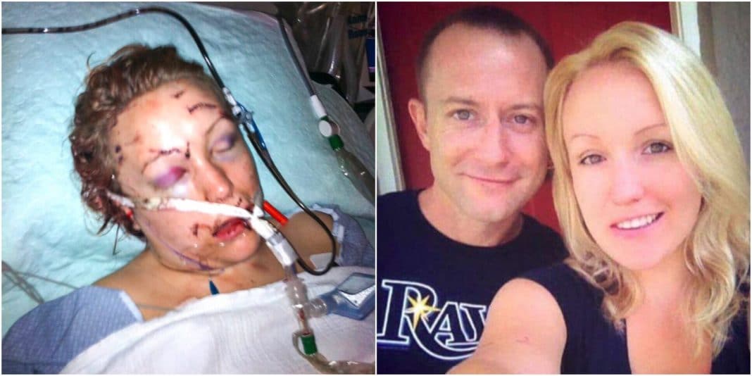Ex stabs her 32 times, leaves her to die. 3 years later EMT that saved her life has 5 words