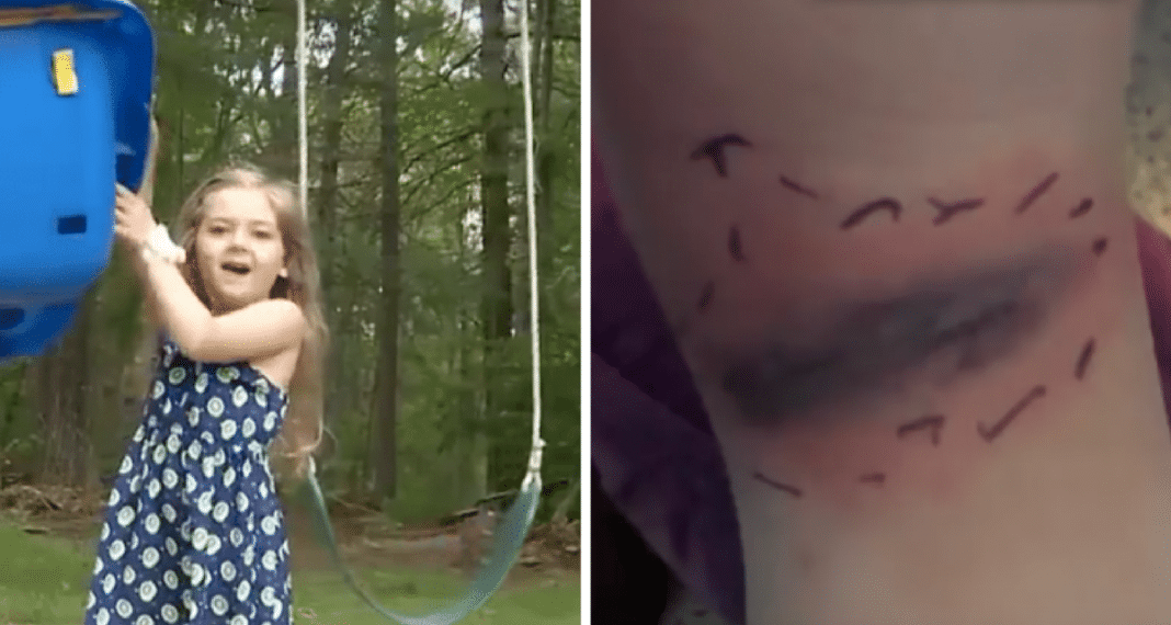 Parents Think Age 5 Daughter Had Bruise On Back Of Knee, Then Doctors Reveal Horrifying Truth