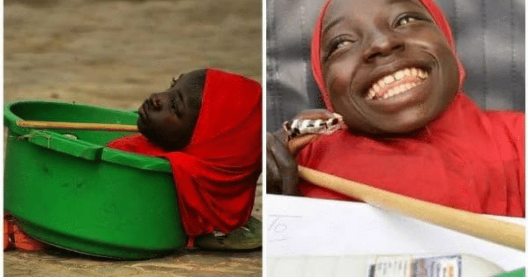 Teen Who Lived Her Entire Life Inside Of A Plastic Bucket Has Passed Away At Age 19