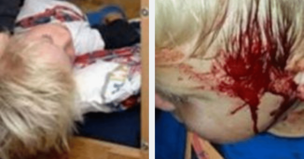 Son’s blood-curdling screams wake mother — she’s shocked at what she sees hanging off his face