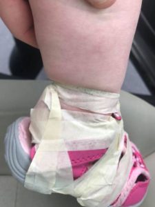The tape wrapped tightly around her child's ankle